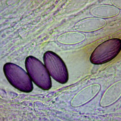 Ascobolus furfuraceus spores